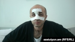 Հայկ Խանումյանը Ստեփանակերտի հիվանդանոցում: 7-ը հուլիսի, 2016 թ․