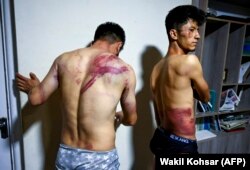 Ziariștii afgani de la Etilaatroz, Neamat Naqdi (stânga) și Taqi Daryabi își arată rănile în redacția lor din Kabul după ce au fost eliberați de talibani - 8 septembrie 2021