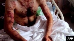 مردی که پس از گریز از سرکوب‌های تظاهرات در سوریه در بیمارستانی در استان مرزی ختای ترکیه به‌سر می‌برد. ۸ ژوئن ۲۰۱۱.