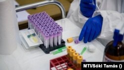 Mintavételhez használt kémcsövek a koronavírus-szűrések elvégzésre kijelölt rendelőben a Mohácsi Kórházban 2020. május 12-én
